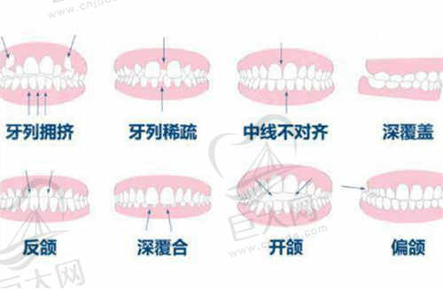 河源泰康拜博口腔医院特色项目及技术