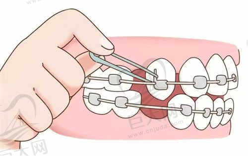 南宁牙未来口腔医院部分热门手术价格