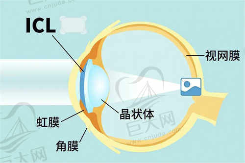 武汉爱尔眼科汉口医院收费价目表