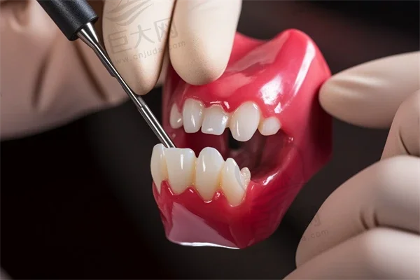 大连种牙技术牙科医院排名榜公布（最新）！大连舒美口腔诊所(诺维溪谷店)医生手术专业、设备先进正规！