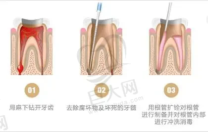 大连烤瓷牙哪一家医院好？