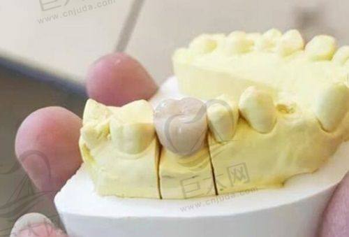 王牌医生陈思韩的种牙实力