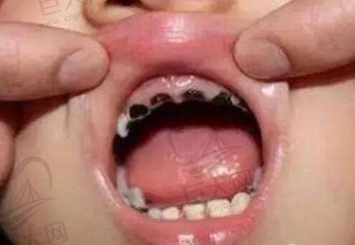 湛江牙加美口腔医院是正规的吗