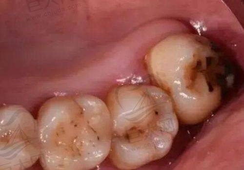 登特口腔预约方式