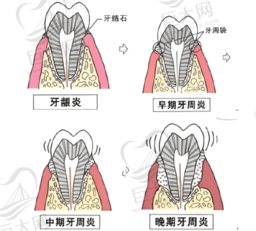 总结