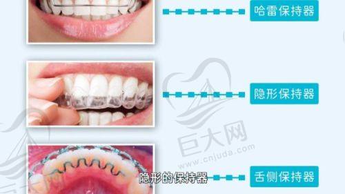 合理收费项目多