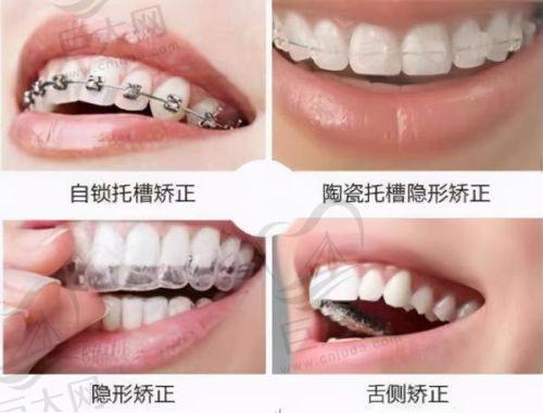 文章总结