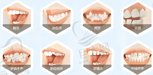 核心优势与性价比
