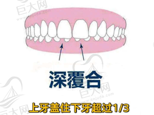 综合对比与建议