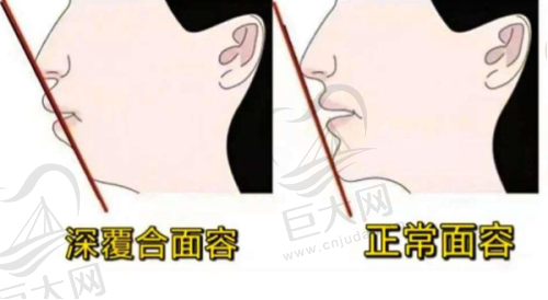 北极星口腔收费价目表