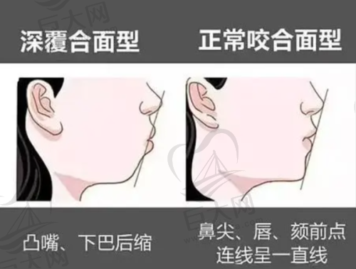 总结