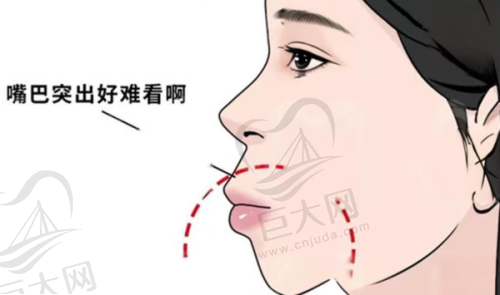青浦美乐口腔种牙价格及其他项目收费