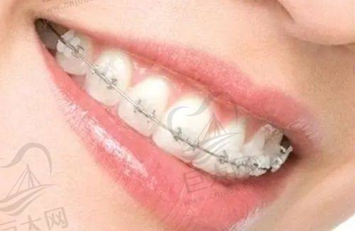 其他口腔项目价格