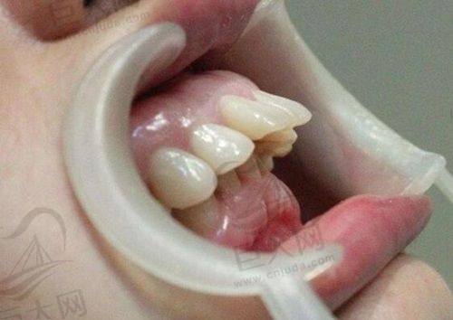 深圳启飞齿科总部简介