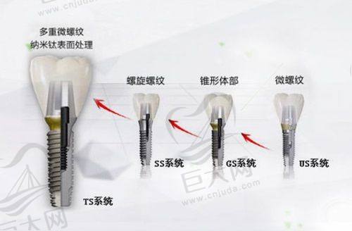 济南历城亿佳、佳鹊、邦齿洁口腔详细介绍