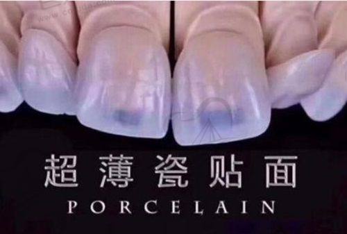 荆门小白兔口腔
