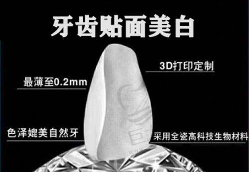 上海静安区种植牙医院排名榜首——维乐口腔介绍