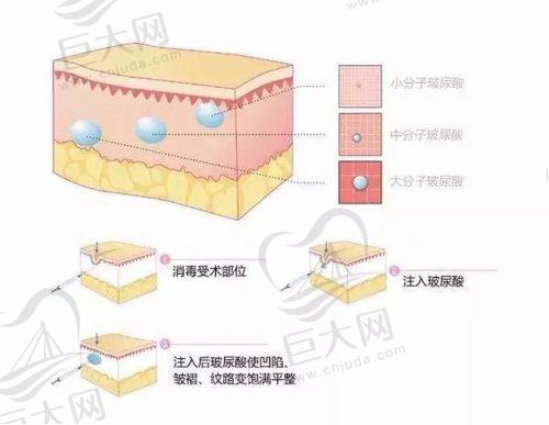 四、广州艺星医疗美容医院​