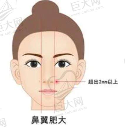 乌鲁木齐缩小鼻孔手术一般得花多少钱？快来看看缩小鼻孔手术费用的真实情况