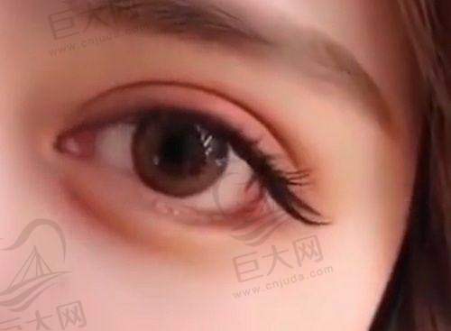 东莞馒化脸修复价格影响因素