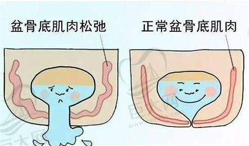 肋软骨隆鼻医院选择建议