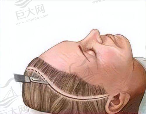 消费者如何根据自身情况选择