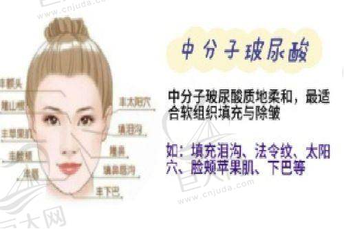 价格优势与项目选择