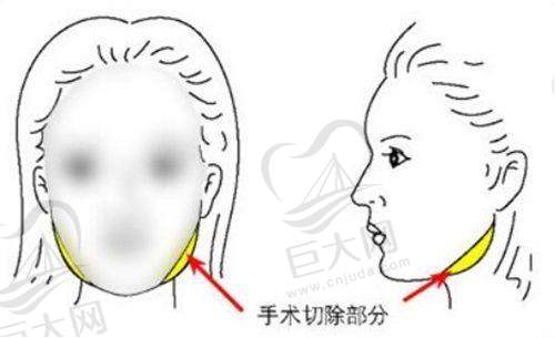 价格参考