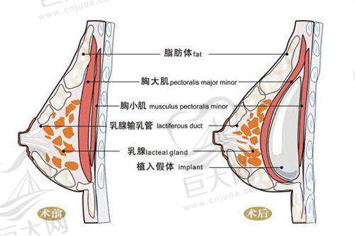 不同手术项目及材料的具体价格