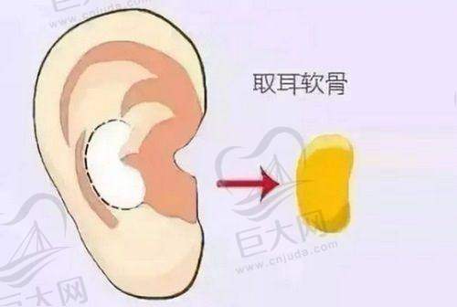整形手术的风险和后续护理