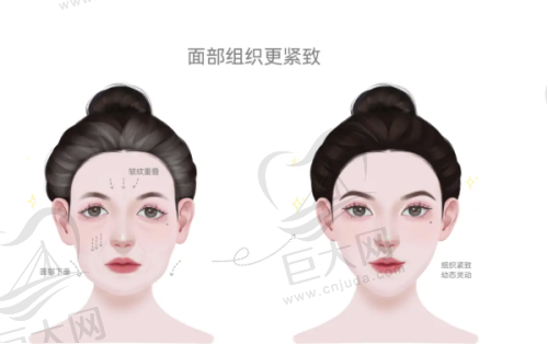 选择北京美莱的优势