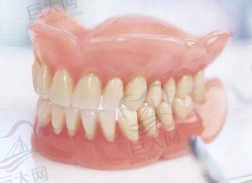青浦维佳康口腔全口种植牙当天完成，术后修复快