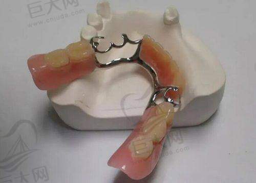 靠谱的牙齿矫正服务