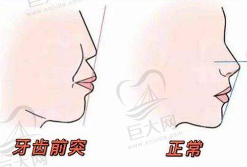 北京佳美口腔收费标准