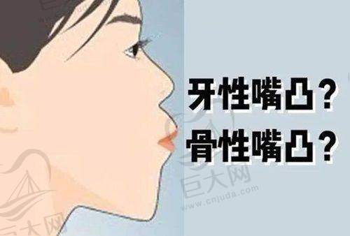 总结