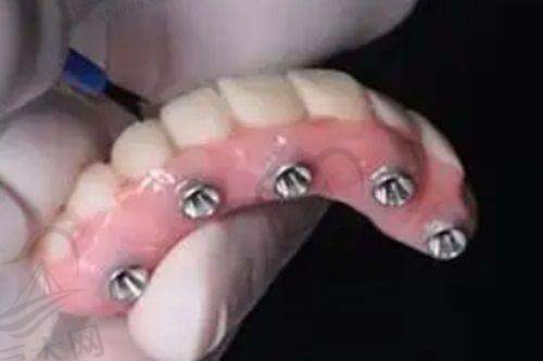 广州德道口腔其他优势