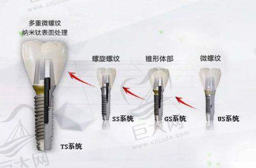 西昌牙博士口腔门诊部的价格