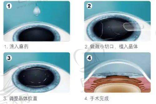 复明眼科医院的历史与科室优势