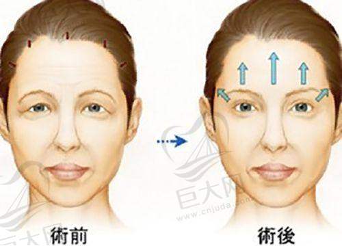 专项技术，优势显著