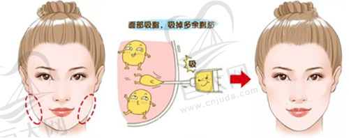 影响费用的关键因素