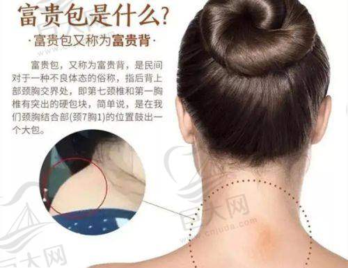 沈阳打唇珠的价格参考实例