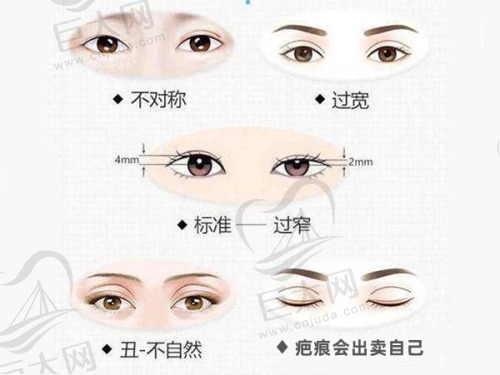 广州艺星医疗美容医院罗盛康胸部整形提前预约方式