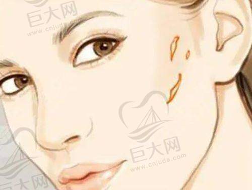 北京嘉禾妇儿医院整形科刘中国医生脂肪丰胸价格多少