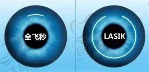通化家长注意！本地眼科医院排名及童星圆多点离焦镜片价格表来了，孩子近视防控选对镜片很重要