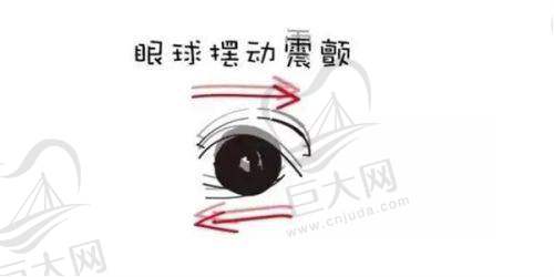 童星圆多点离焦镜片购买及使用保养建议