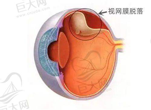 眼科医院询问方式