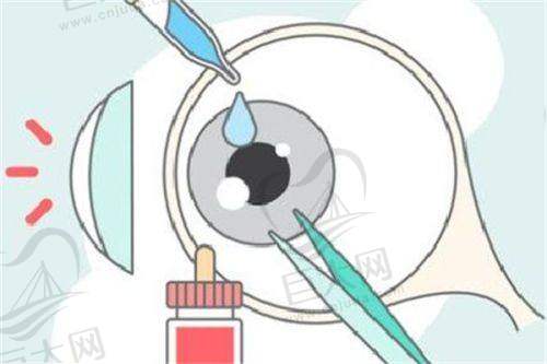 长沙矫正视力不知道选哪家？中南大学眼科医院值得考虑！还有独家9800元矫正套餐