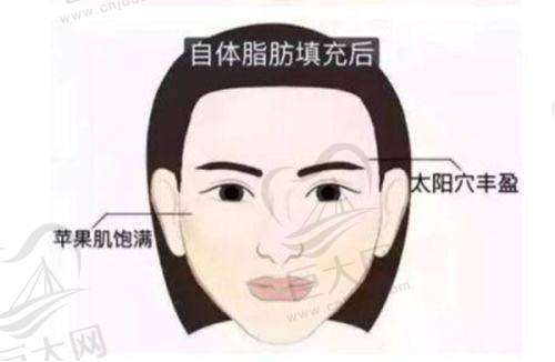 广州艺星医疗美容医院孙湄杨修复手术的成功实例展示