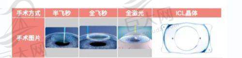 衢州全飞秒手术价格分析