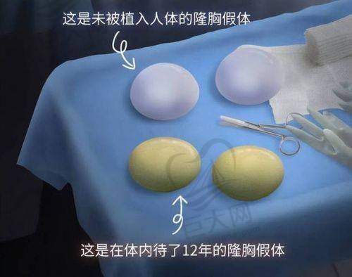 北京英煌美容医院项力源脂肪丰胸价格详情